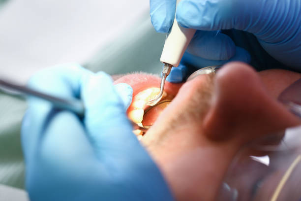 Best Emergency Root Canal Therapy in Mcloud, OK