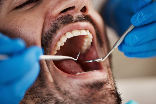 Best Dental Abscess Treatment in Mcloud, OK